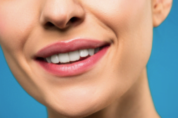 Albirea dinţilor la cabinetul dentar – singură şi cea mai eficientă metodă de cosmetizare a danturii